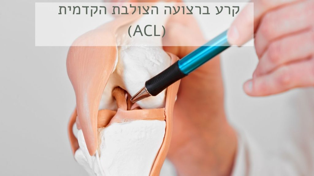 קרע ברצועה הצולבת הקדמית (ACL) אצל ספורטאים