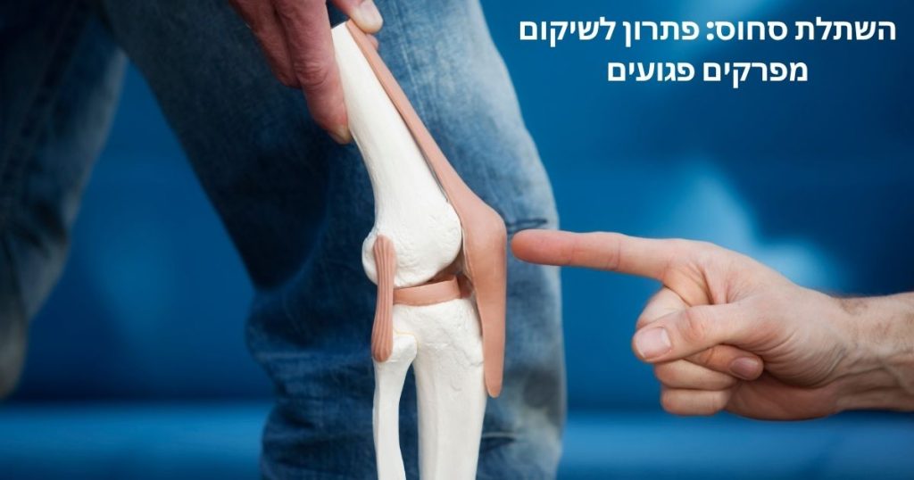 השתלת סחוס